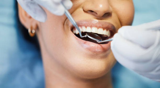Best Root Canal Emergency Dentist  in Lambert, MS