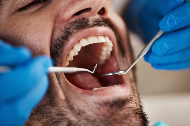 Best Tooth Infection Emergency Dentist  in Lambert, MS